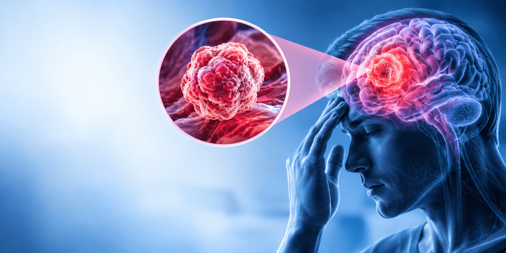Brain Tumor: Symptoms, Causes, Diagnosis & Treatment | Pink Star Hospital