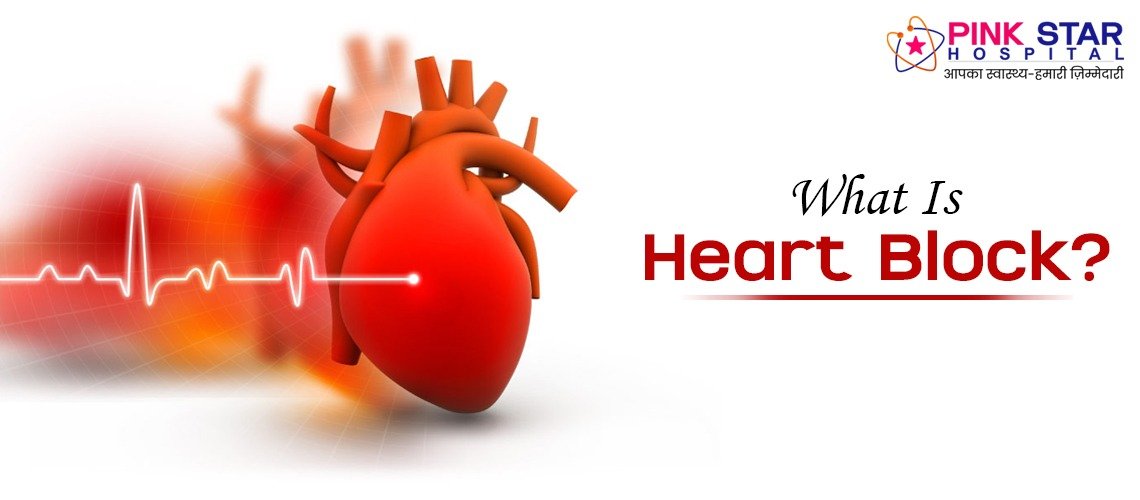 What Is Heart Block?