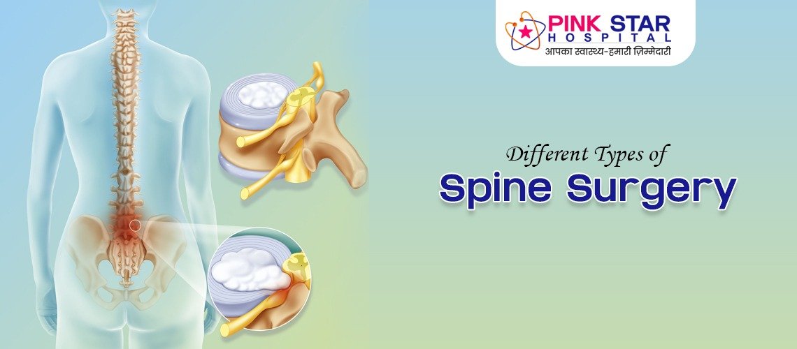 Different Types of Spine Surgery